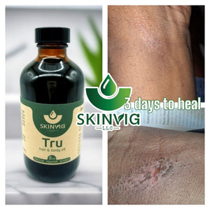 Tru (Face) Body Oil